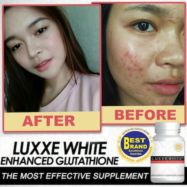 luxxe glutathione review Luxxe White Enhanced Glutathione Review – imfrontrow